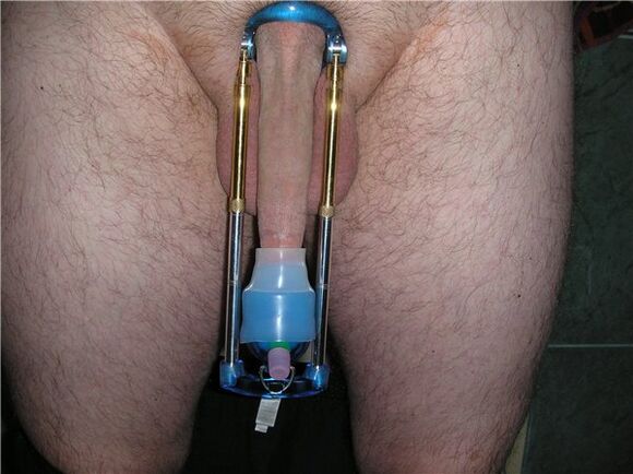 Zgjatues - pajisje për zgjerimin e penisit